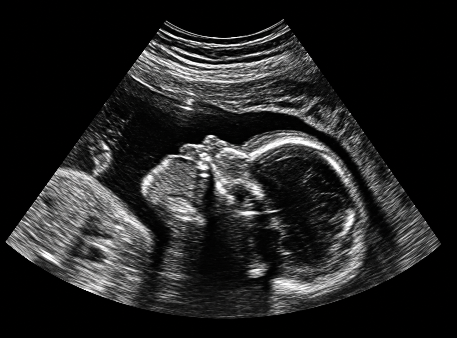 Ultrasound examination